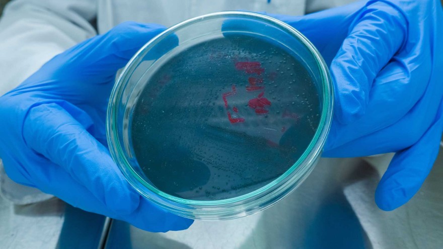 Antibiotika Resistenzen