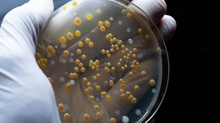 Antibiotika Resitsnezen